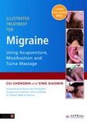 Illustrated Treatment for Migraine Using Acupuncture, Moxibustion and Tuina Massage